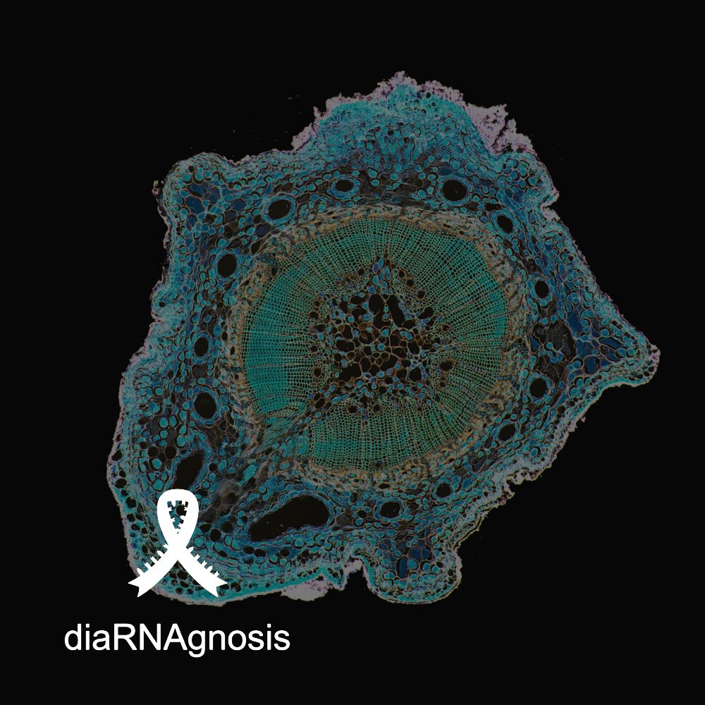 DiaRNAgnosis_A novel platform for the direct profiling of circulating cell-free ribonucleic acids